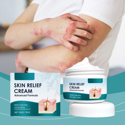 Haarfollikel-Pflegecreme Pflege für Kopfhaut, Rücken und Gesicht Reinigung und Reparatur Akne Haarfollikel-Pflegecreme