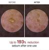 Exfoliating White Rice Essence Facial Barrier Repair Black Rice Essence Gentle Exfoliator Brightening Hydrating Skin Repair 
