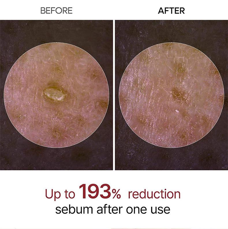 Exfoliating White Rice Essence Facial Barrier Repair Black Rice Essence Gentle Exfoliator Brightening Hydrating Skin Repair