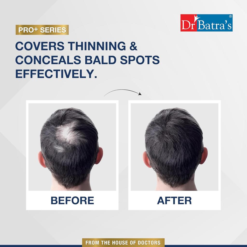 Dr Batra's Pro Instant Hair Dark Brown Keratin Hair Fibre for Bald Spot Coverage Thickening 12gm