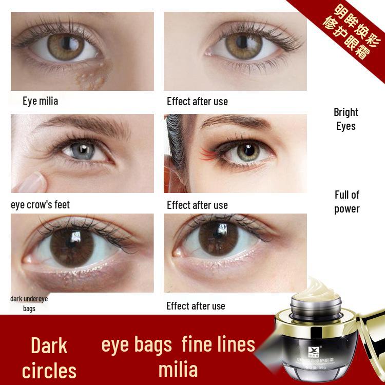 DSM Eye Cream for Dark Circles, Eye Bags, Fine Lines, and Milia - Lifting and Firming Formula