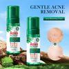 Tea Tree Mousse facial cleanser 150gSADOER Cleansing Bubble Cleanser