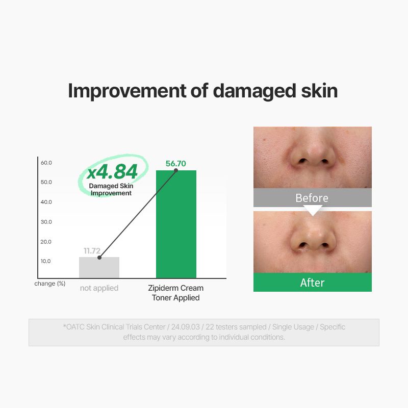 [zipiderm] EGF Skin Barrier Cream Toner 150ml