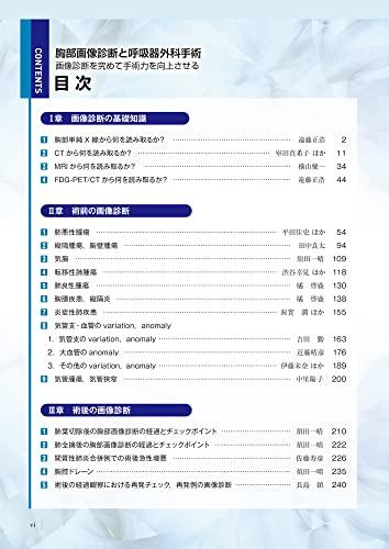 Chest Imaging and Thoracic Surgery