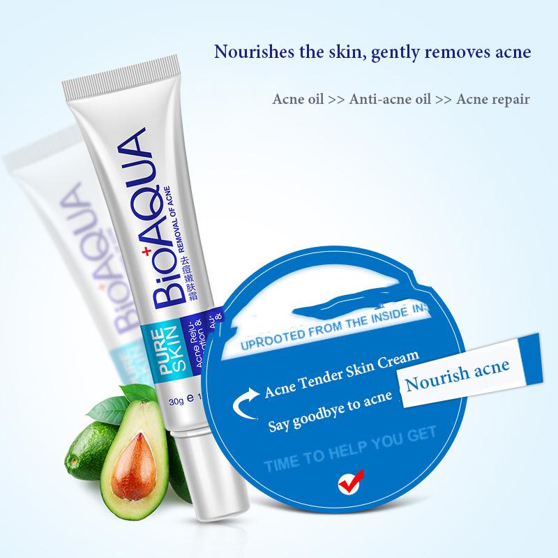 BIOAQUA Acne Treatment Cream Oil Control Shrink Pores Face Care Cream 30g