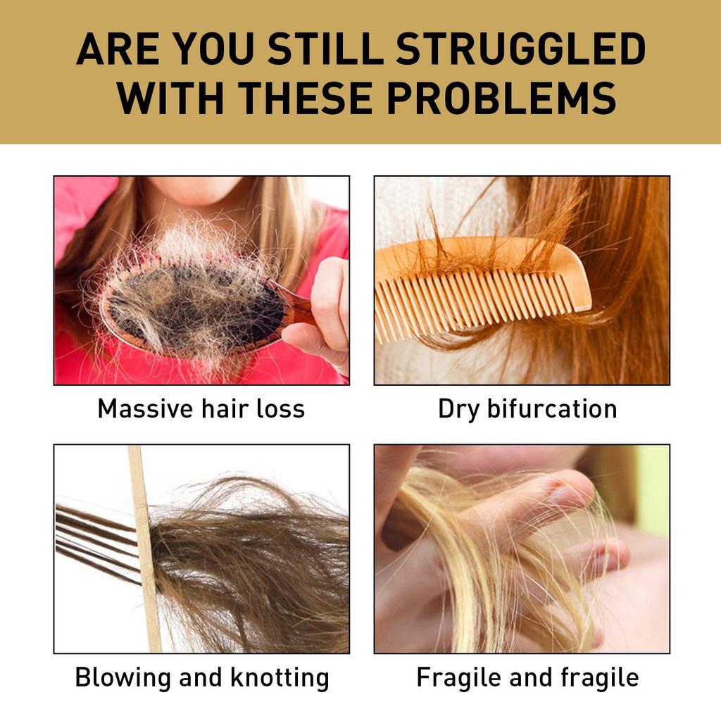 Jaysuing Ginger Anti-Hair Loss Shampoo 100ml - Herbal Natural Shampoo for Oil Control, Hair Growth, Thickening, Anti-Hair Loss, and Strengthening.