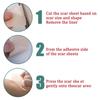 Scar Removal Gel Tape Self Adhesion Reusable Painless Scars Treatment Tapes for Hyperplastic Scars 59.1in