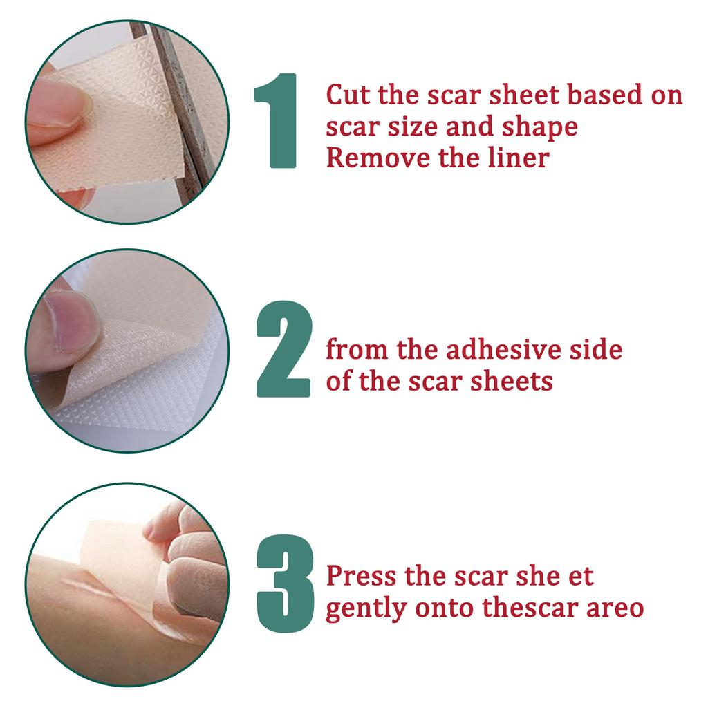 Scar Removal Gel Tape Self Adhesion Reusable Painless Scars Treatment Tapes for Hyperplastic Scars 59.1in