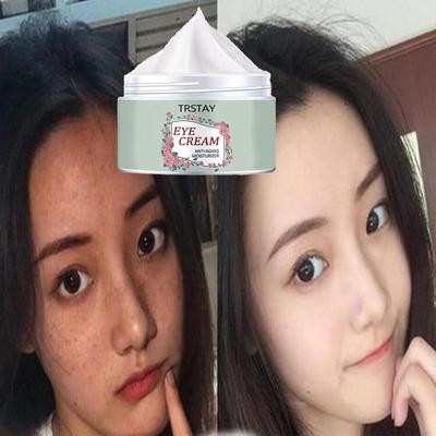 Krém na obličej Body Podpaží Krém na bílé Skin White Skin Whiteing crema para blanquear la cara