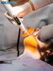 NICEDEN Wireless LED Dental Curing Light  Portable Cordless Polymerization Lamp for Composite Resin