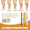 Upgrade Varicose Veins Laser Pen, Spider Vein and Leg Blood Painless Treatment With,Medical Grade 980Nm Infrared Therapy Device