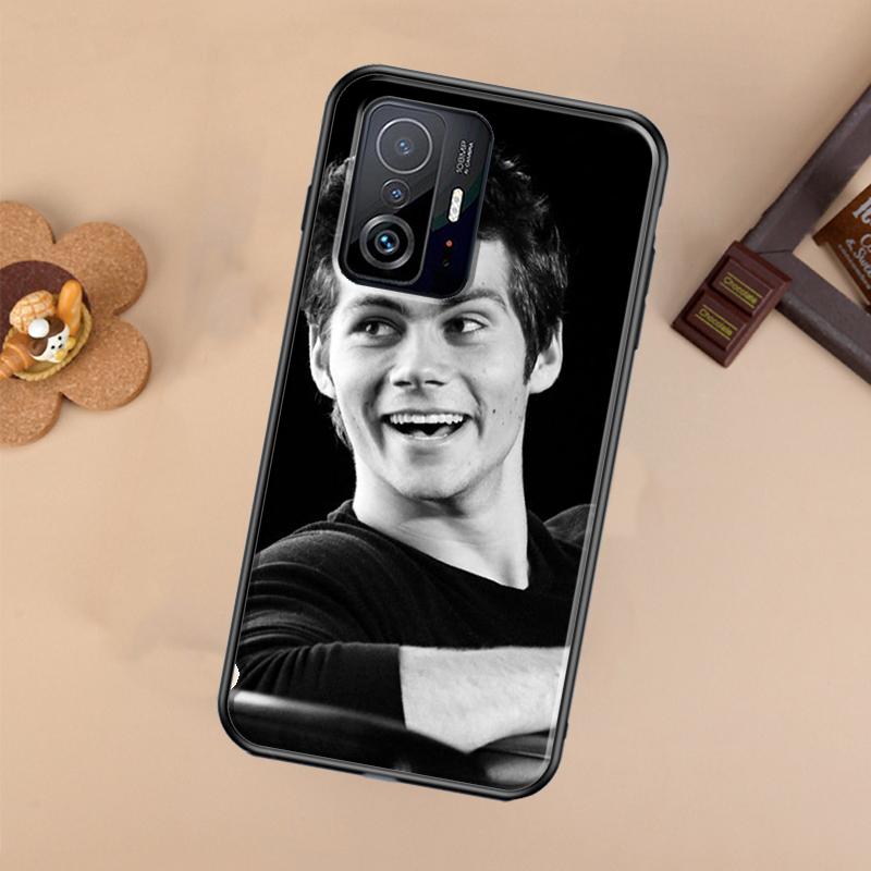 Teen Wolf Dylan Obrien Case For Xiaomi POCO X7 X6 Pro X3 X5 M6 F3 F5 F6 Pro 11T 12T 13T 14T Pro 13 14 Ultra Cover