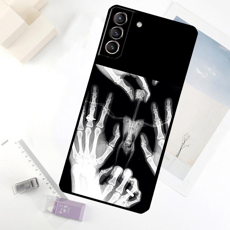 Xray Art Aesthetic Skull Phone Case For Samsung Galaxy S25 S26 Ultra S20 S21 S22 S23 S24 Ultra S10 Plus S25 FE Cover