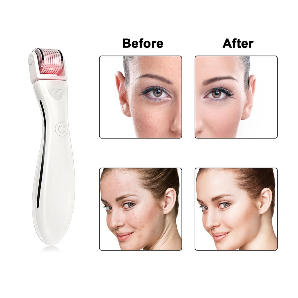 Derma Roller Microneedling Device for Home & Salon Use with 3 Replaceable Heads Red Light for