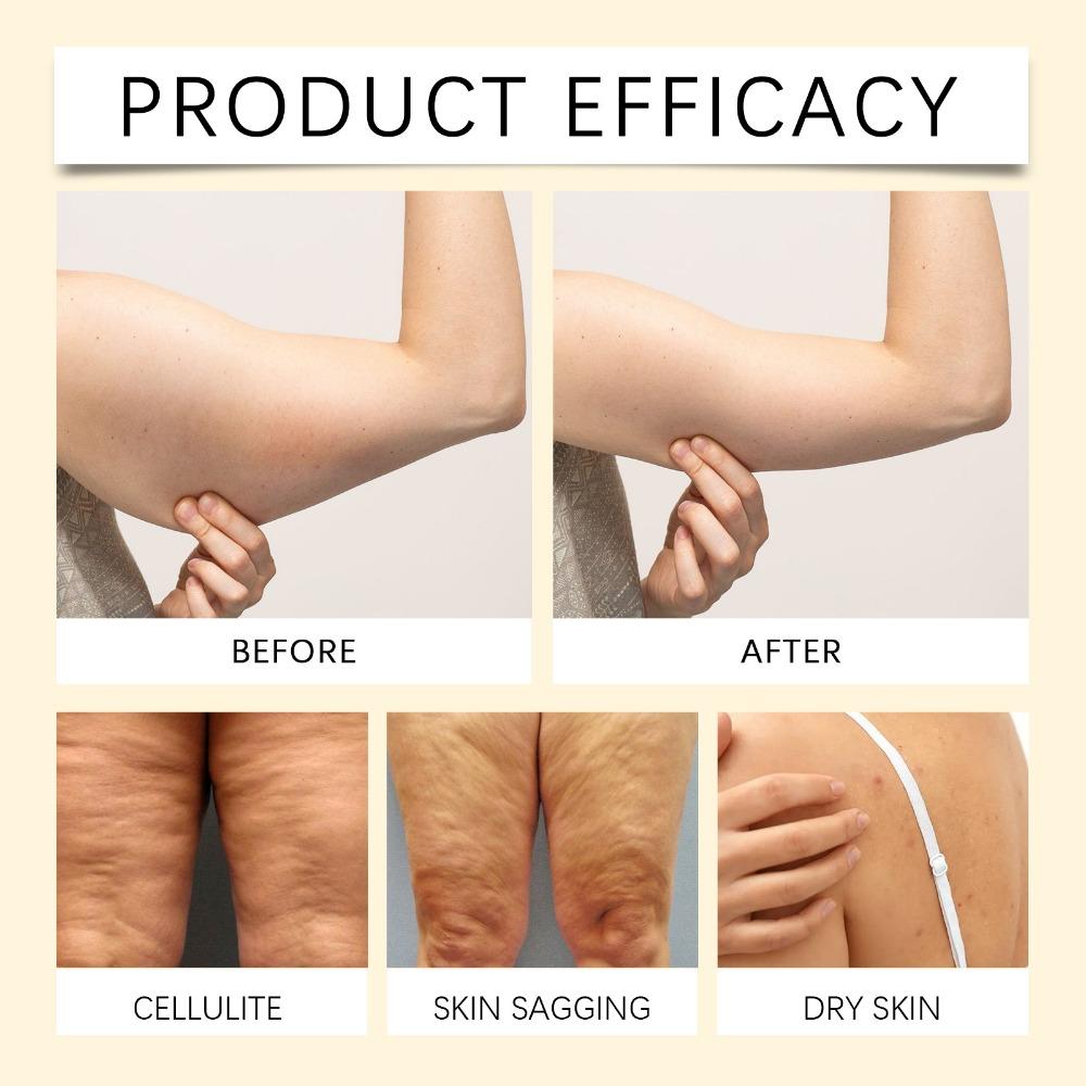 Intense Moisturizing and Firming Body Cream, Daily Nourishing Skincare with Tightening Formula