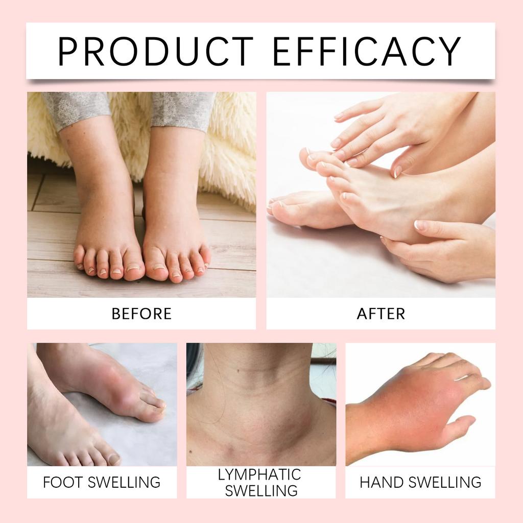 Healthy And Soothing Gel Fluid Retention Lymphatic Drainage To Control Edema