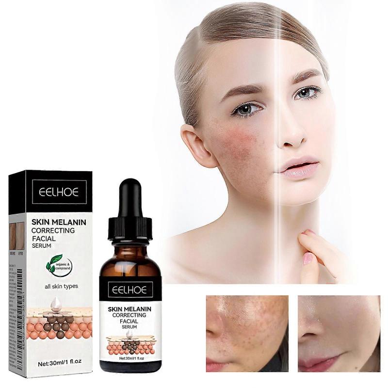 Melanin Correcting Facial Serum, Fade Dark Spots Anti Freckle Melasma Remover Lightening Pigment Blemish Vitamin C Face Essence