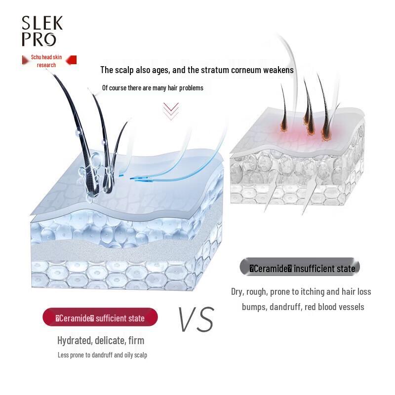 ShuLei Refreshing Oil Control Anti-Dandruff Shampoo