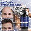 Biotin Hair Growth Shampoo for Men: Natural Thickening Shampoo with Rosemary & Batana Oil for Hair Loss and Thinning Hair, Strengthening Roots, 300ML