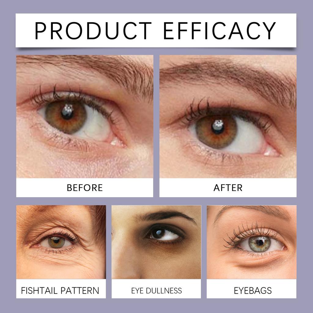 Eye Cream Effectively Nourishes The Skin Around The Eyes, Daily Care For Glowing Skin Care, Apply Eye Cream