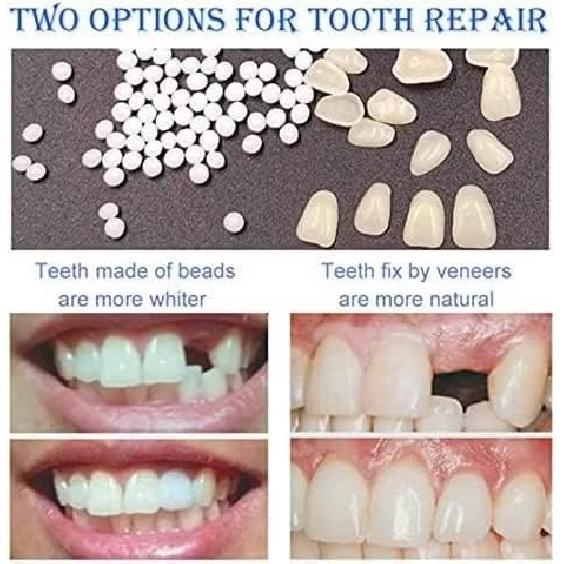 Fake Tooth Repair Kits DIY Dental Care Kit Glue for Filling Missing Broken Teeth Crowns and Bridges Moldable Fake Teeth to Regain Your Beautiful