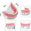 Modello Denti Dentali Trasparente 4 Impianti Overdenture Ponte Rimovibile Modello Mandibolare Inferiore M6003 Materiali per Studio Dentistico