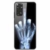 Tempered Glass Case For Xiaomi mi 10T Pro Cover Hard PC Coque for Xiaomi mi 10T Lite Protective Cases mi10T Pro Lite Fundas