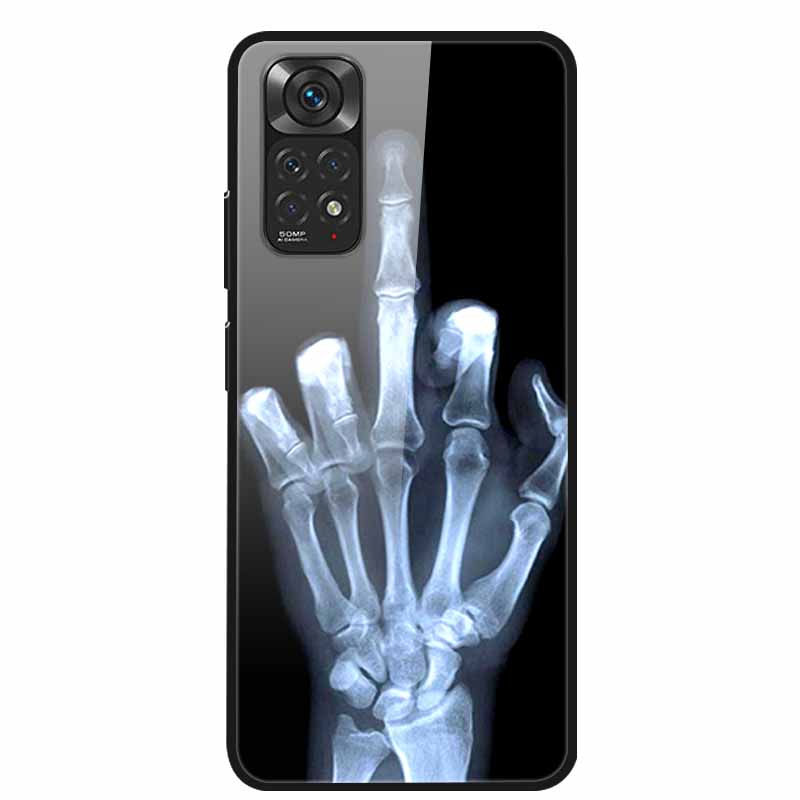 Tempered Glass Case For Xiaomi mi 10T Pro Cover Hard PC Coque for Xiaomi mi 10T Lite Protective Cases mi10T Pro Lite Fundas