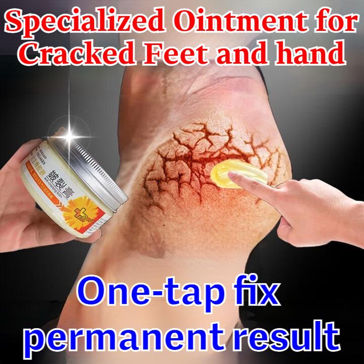 Cremă specială pentru crăpături pe mâini și picioare, crăpături uscate pe călcâie, crăpături uscate, infecție fungică, crăpături cauzate de degerături