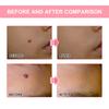 30ml Cleansing SkinRemoving Skin StainsHand and Foot CallusesFlesh SpursSkin Conditioner
