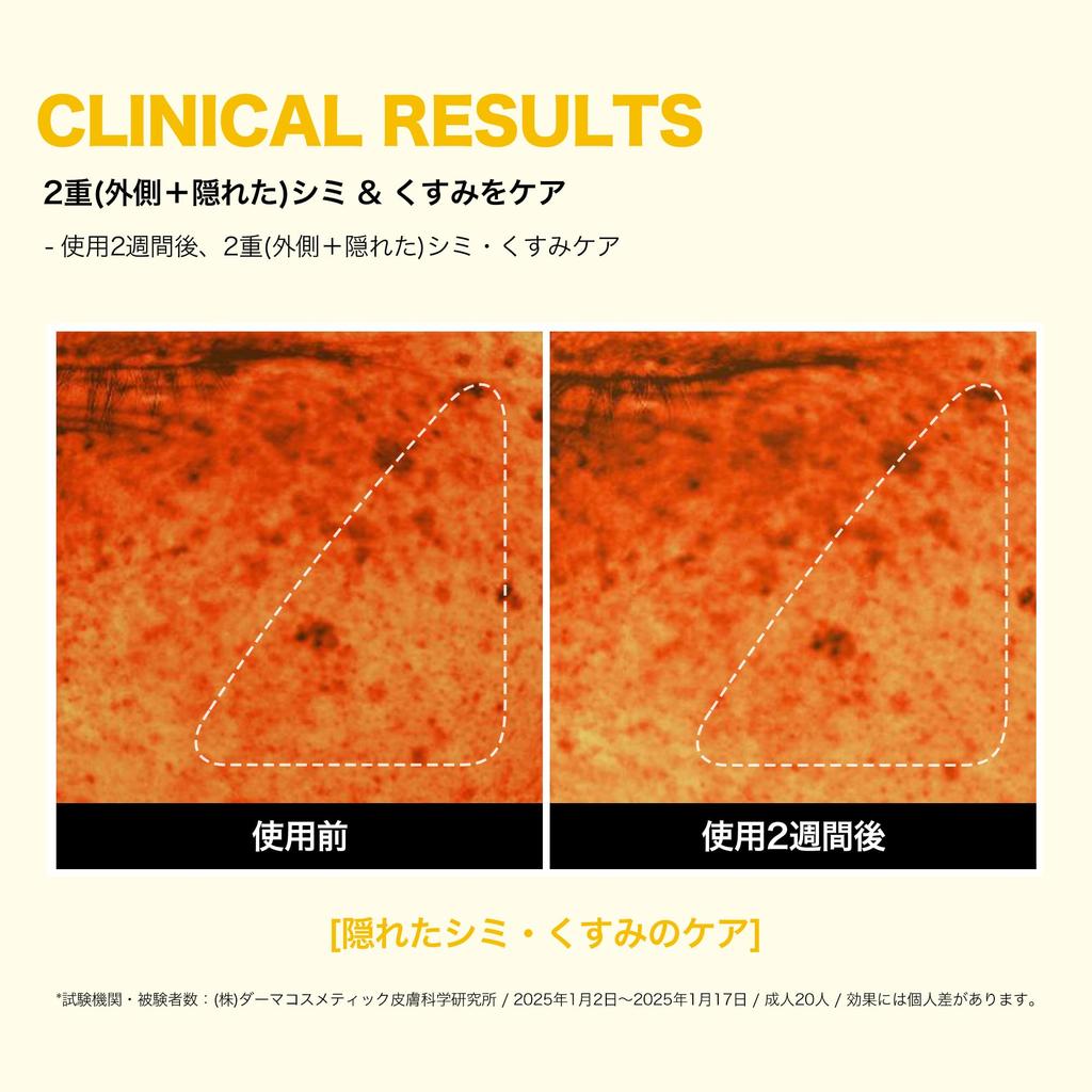 SOME BY MI Yuja Niacin Daily Mask Face mask with yuzu fruit and vitamin Korean Anti-Blemish (30 sheets, 370ml) - niacinamide, extract, arbutin, C.