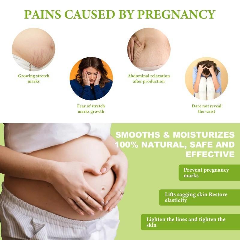 Ouhoe Skin Smoothing Cream Moisturizing Formula For Scar Reduction And Stretch Marks