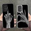 Funny X-Ray Hand Bones Shockproof Phone Case for Samsung A17 A16 A15 A14 A37 A57 A36 A56 A26 A35 A55 A25 A34 A54 A24 A13 A23 A33