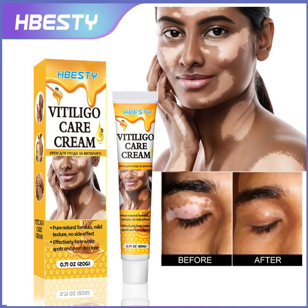 

White Spot Hbesty Cream Relaxing Herbal Massage Balm For Universal Skin Care