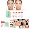 Eelhoe Colorful Acne Patches Gentle Non-irritating Hydrocolloid Treatment For Blemishes And Pimples 144pcs