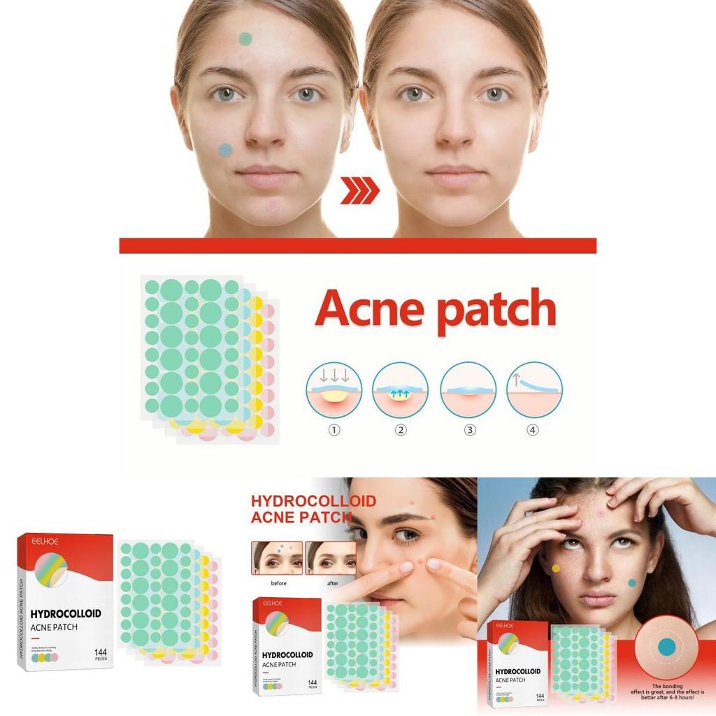Eelhoe Colorful Acne Patches Gentle Non-irritating Hydrocolloid Treatment For Blemishes And Pimples 144pcs