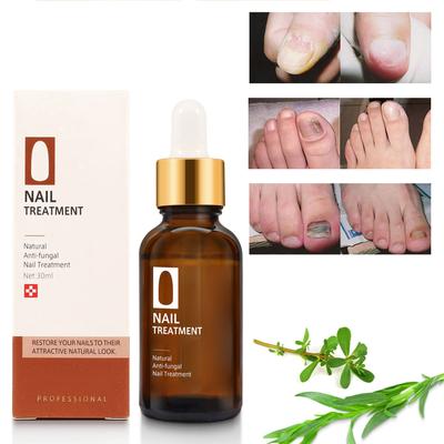 Nail Care Cream Oil, Herbal Plant Hand And Foot Gray Nail Care Cream Oil 30ml