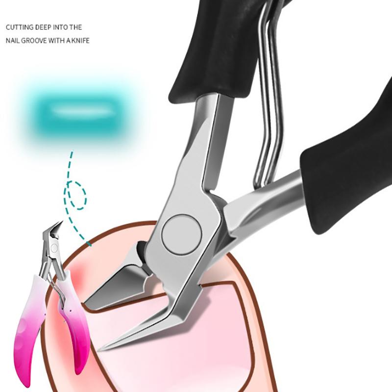 Nagelknipser, Nagelhautzange, professionelle Schere zum Entfernen eingewachsener Zehennägel, abgestorbener Haut, Nagelknipser aus Edelstahl, Pediküre-Werkzeug