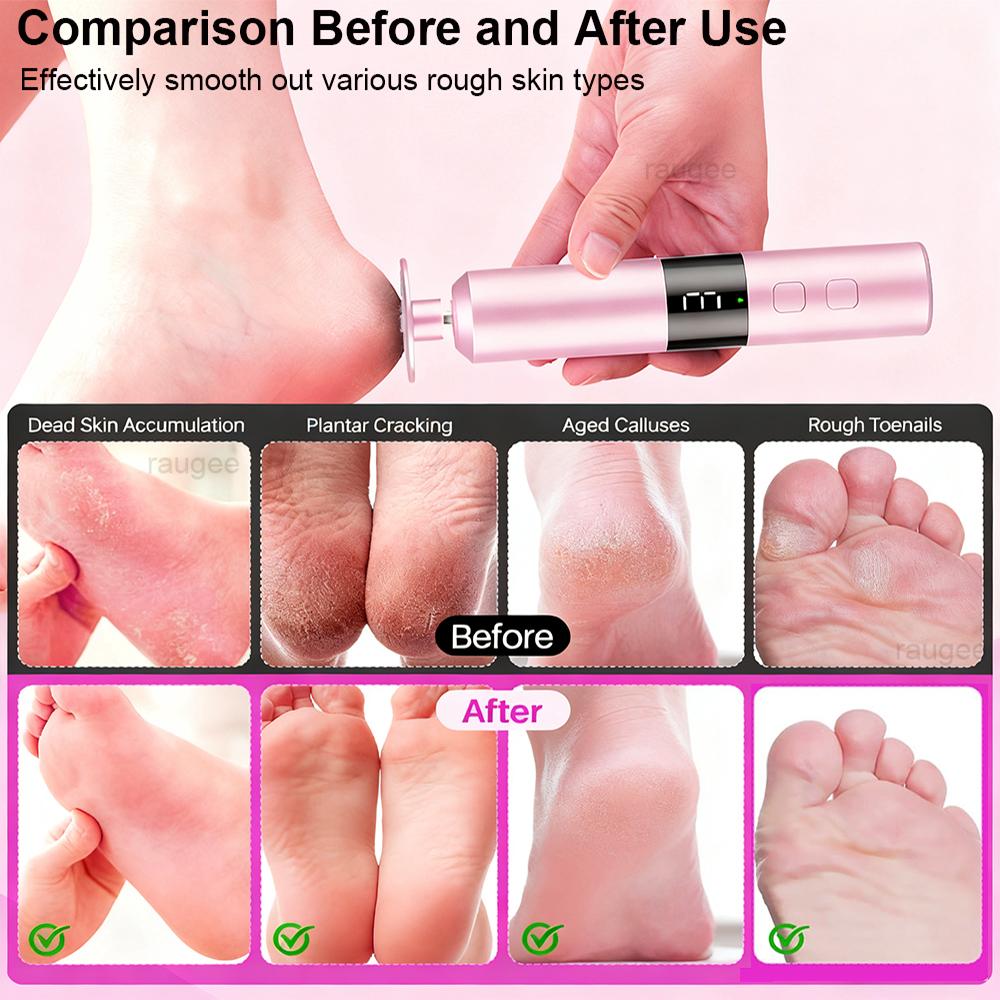 Electric Foot Grinder Foot Exfoliation Sander Electric Callus Remover Electric Foot File Pedicure Machine Foot Dead Skin Remover