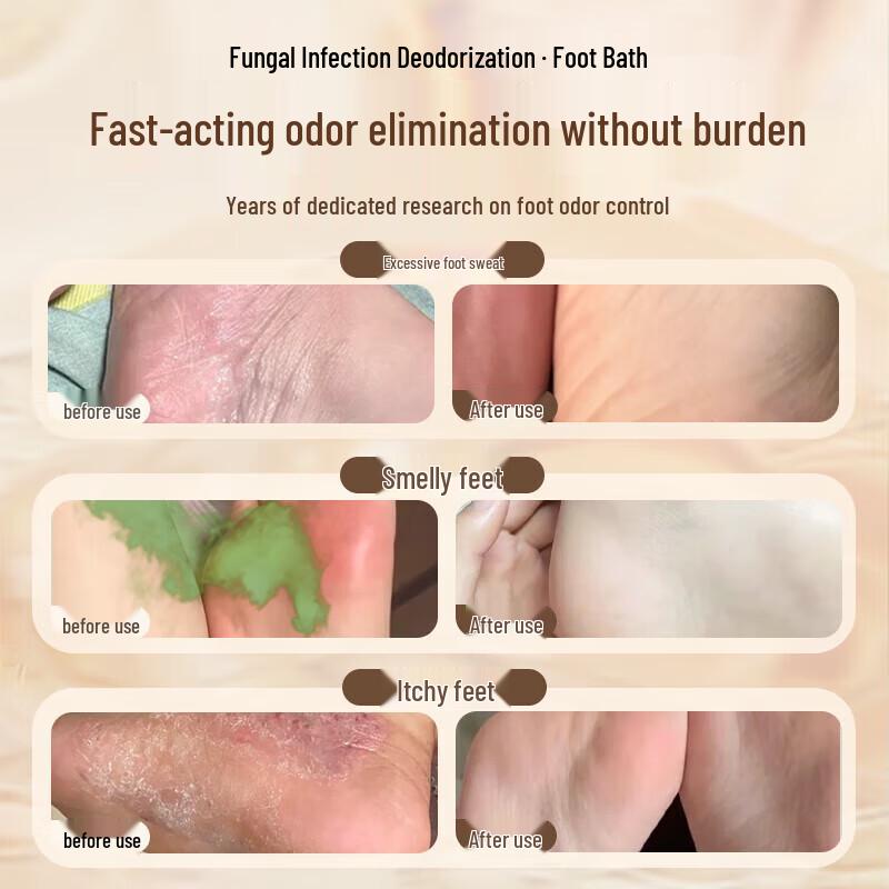 BEAI Athlete's Foot & Odor Relief Foot Soak Powder