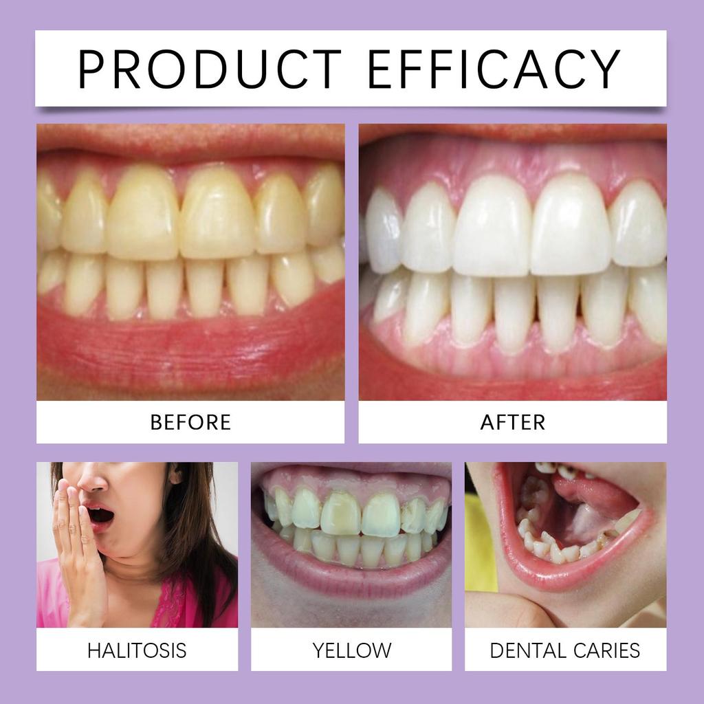 Oralhoe Гель для чистки зубов Мягкая ежедневная чистка Усиливающий пятновыводитель Отбеливающий уход за зубами