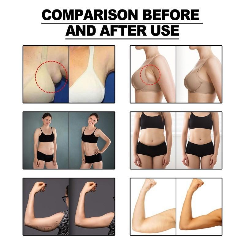 Plasturi Eelhoe pentru Îngrijirea Corpului Limfatic Alinare Confortabilă Pentru Zone Umflate ale Gâtului și Axilelor