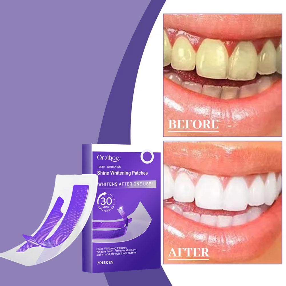 7 buc. Benzi Violet pentru Albirea Dinților Îndepărtarea Profesională a Petelelor Dentare Kit de Albire Dentară pentru Dinți Sensibili Îngrijire Orală