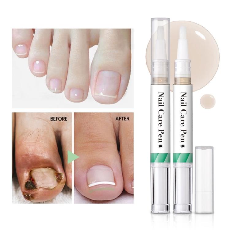 2x/Sada Péče o nehty Pero s olejem na kůžičku Pero s olejem na růst nehtů Péčující olej na nehty pro vyživené nehty na rukou i nohou
