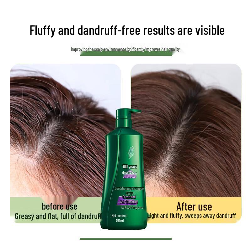 100 Years Runfa Fresh Anti-Dandruff Shampoo