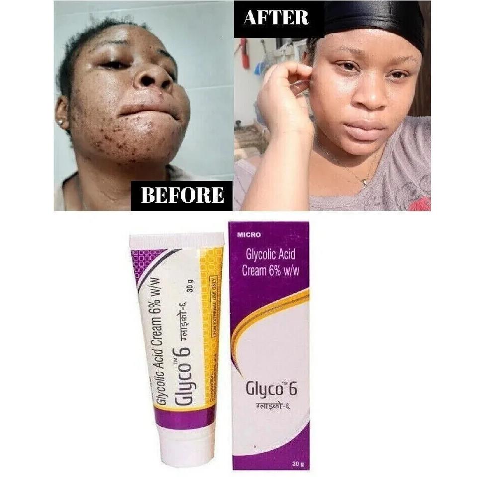 GLYCO 6 GLIKOLSKĀBES KRĒMS 6% 30g