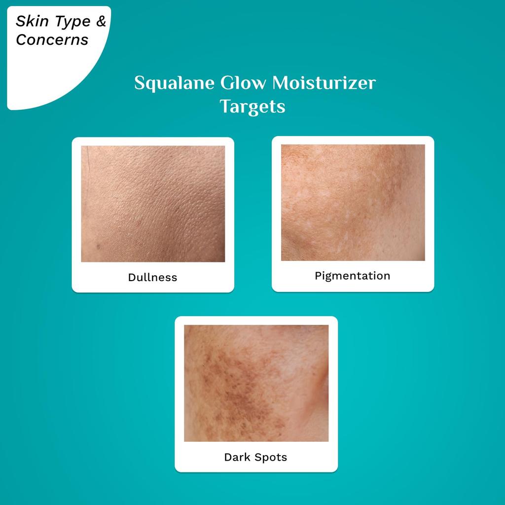 Squalan Niacinamid & Vitamin C Glow Feuchtigkeitscreme für das Gesicht | Feuchtigkeitscreme zur Hydratisierung trockener Haut | 50 g, Creme