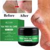 Herbal Anti Crack Foot Cream Heel Cracking Repair Products Exfoliation Dead Skin Removal Softening Moisturize Smooth Skin Care