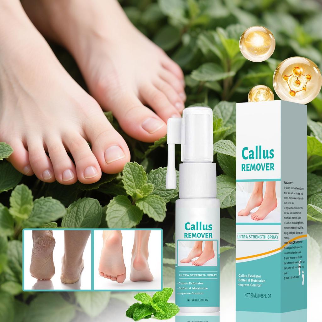 Foot Keratin Remover, Keratin Removal Spray, For Heel Calluses And Dead Skin Foot Care Spray,20ml