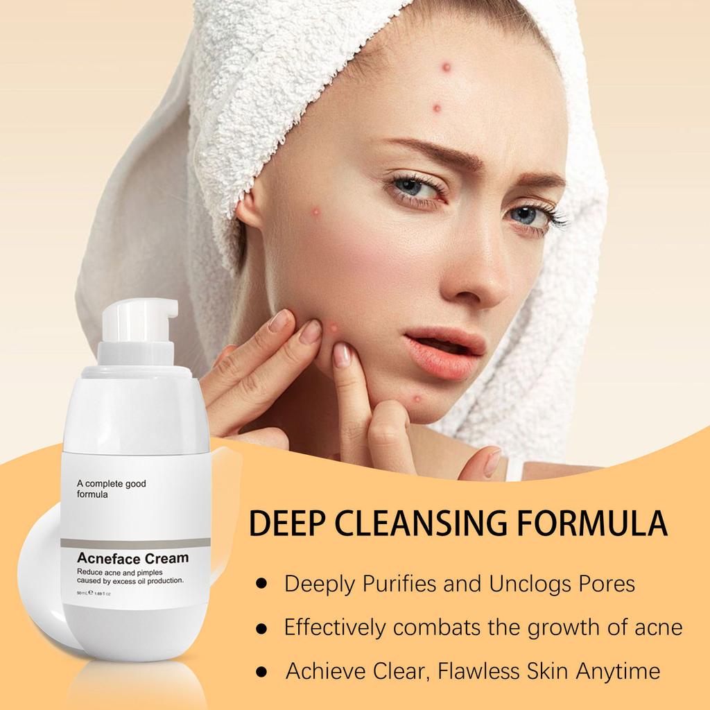 Facial Acne Cream Gentle Nourishing And Fading Facial Acne Marks And Blue Acne To Remove Closed Comedones Cream